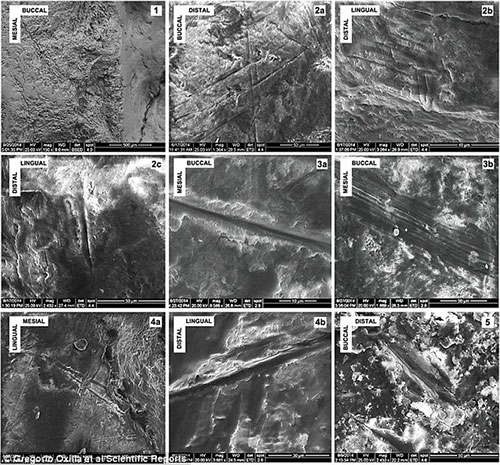 Des traces du forage de la dent