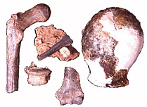 Australopithecus anamensis