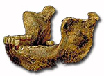 Mandibule de Mauer