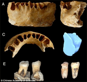 Machoire et dents de l'homme de Zhirendong