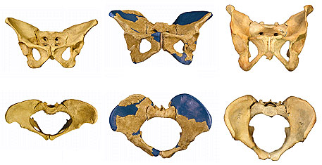 Comparaison du bassin d'homo erectus