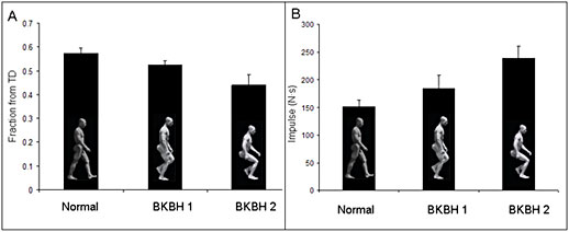 les differents type de bipédie 