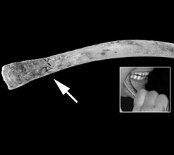 Traces de mastication humaine sur des ossements 